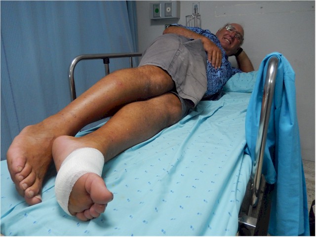Keith's souvenir: a sea urchin spine in the foot which required a quick trip to hospital!